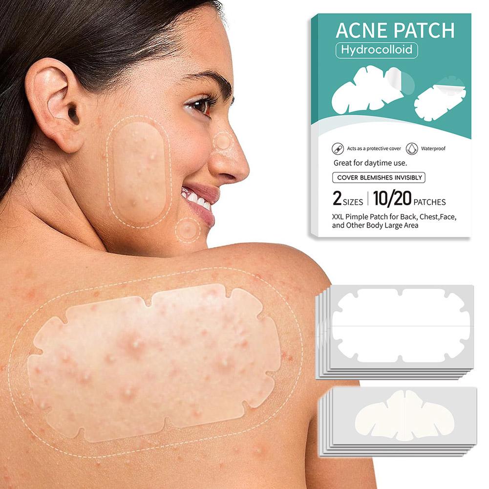 Remendo de acne de combinação  - Skincare Oil Control avaliação e preço